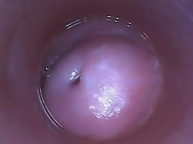 vagina
