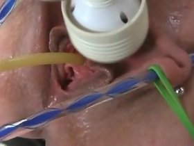 Catheter insertion be advantageous to herself